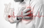 Лечение давления при инфаркте миокарда у женщин и мужчин