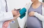 Симптомы и лечение преэклампсии при беременности и после родов