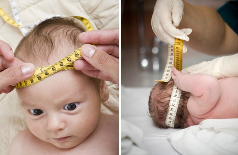 ребенку измеряют диаметр головы