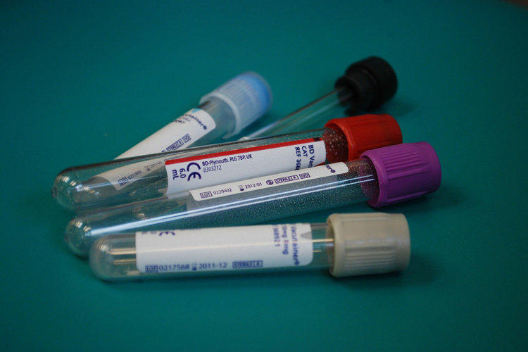 колбы для анализов крови