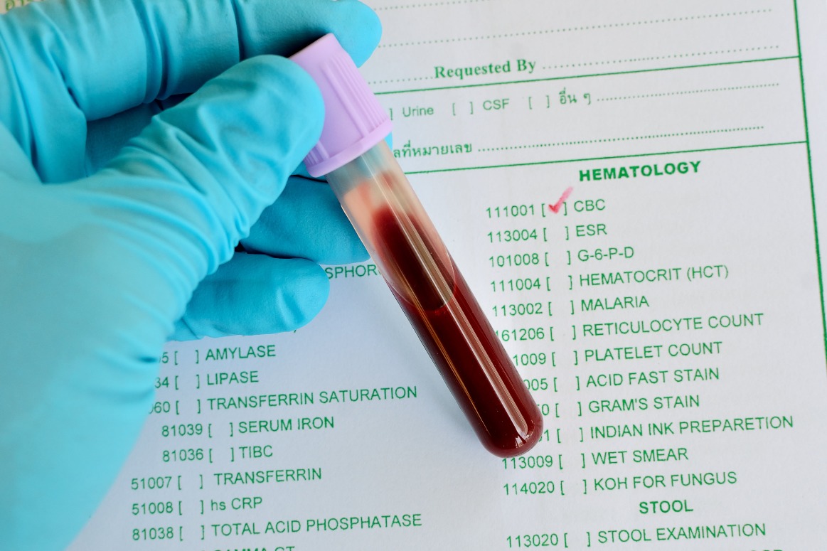 Значение параметра и какие изменения отражает WBC в анализе крови
