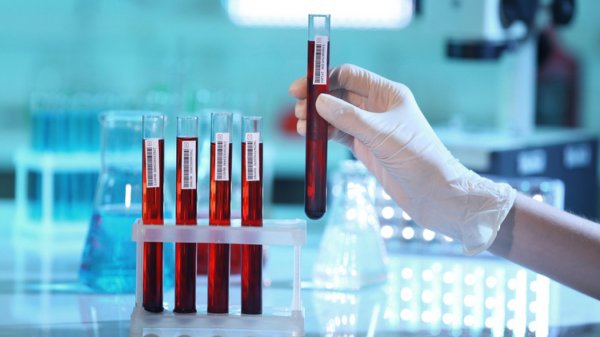 Значение параметра и какие изменения отражает WBC в анализе крови