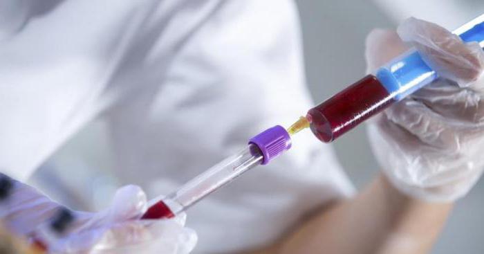 В чем опасности алколоза в крови, как его определить и лечить